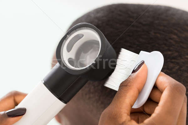 Dermatologist Checking Patient's Hair In Magnifying Glass Stock photo © AndreyPopov