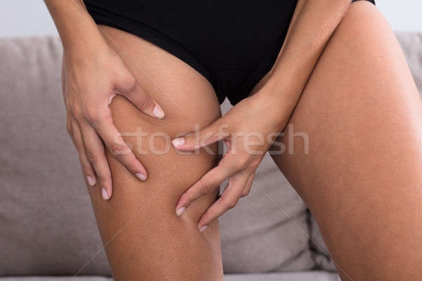 Weiblichen Cellulite Schenkel home Frau Stock foto © AndreyPopov