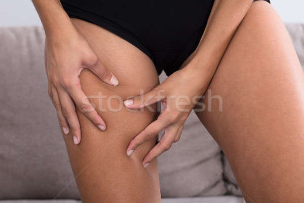 Foto stock: Femenino · celulitis · muslo · primer · plano · casa · mujer