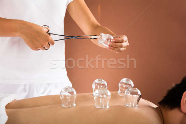 Therapist Giving Cupping Therapy To Man Stock photo © AndreyPopov