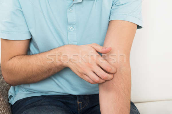 Man Suffering From Itching Stock photo © AndreyPopov