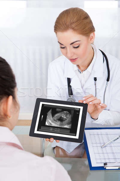 醫生 顯示 超聲 瀏覽 嬰兒 女 商業照片 © AndreyPopov