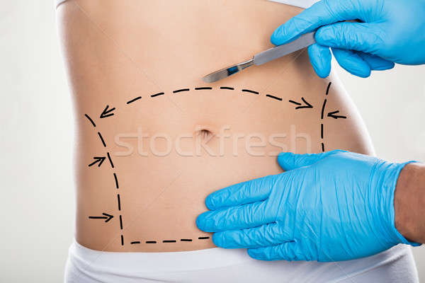Surgeon Hand Holding Scalpel On Belly Stock photo © AndreyPopov