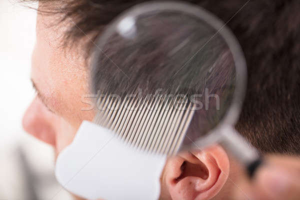 Dermatologist With Magnifier Examining Patient Stock photo © AndreyPopov