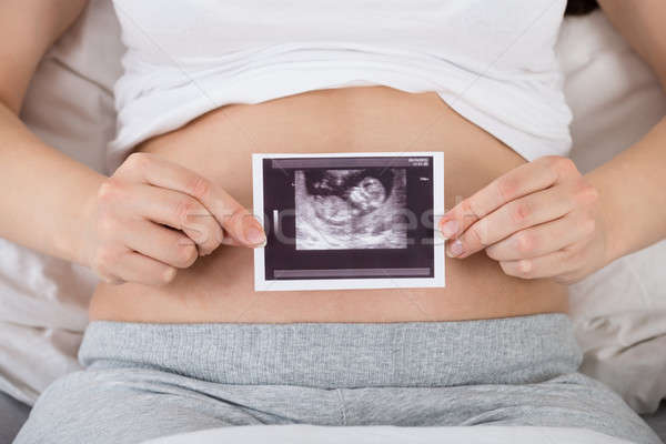 Femme enceinte ultrasons photo bébé femme [[stock_photo]] © AndreyPopov