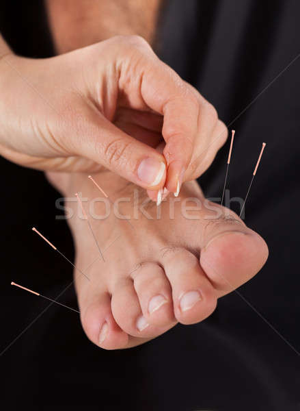 Férfi akupunktúra kezelés közelkép láb kéz Stock fotó © AndreyPopov