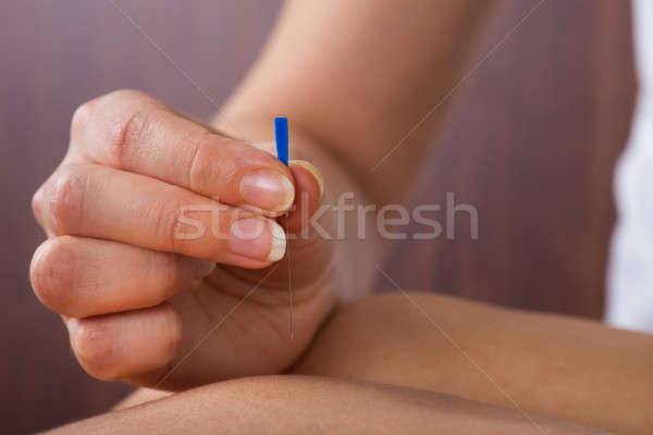 Terapeuta realizar acupuntura tratamiento imagen femenino Foto stock © AndreyPopov