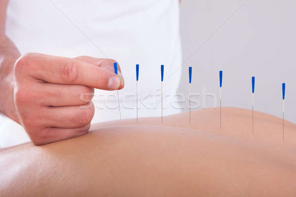 Vrouw acupunctuur therapie jonge mooie vrouw spa Stockfoto © AndreyPopov
