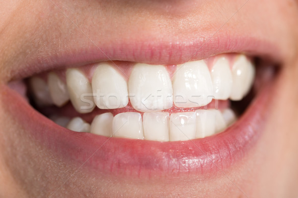 Kadın sağlıklı beyaz diş gülen Stok fotoğraf © AndreyPopov