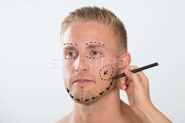 Man With Correction Mark For Plastic Surgery Stock photo © AndreyPopov