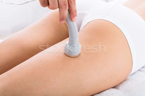 Woman Getting Microdermabrasion Therapy On Her Legs Stock photo © AndreyPopov