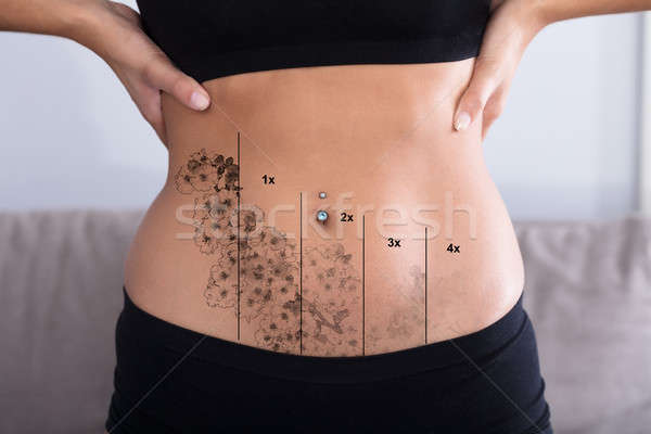 Laser tattoo rimozione stomaco primo piano piercing Foto d'archivio © AndreyPopov
