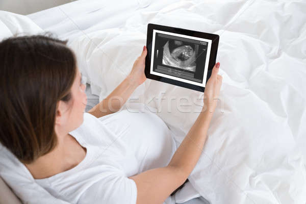 Foto stock: Mulher · grávida · olhando · raio · x · digital · comprimido · quarto