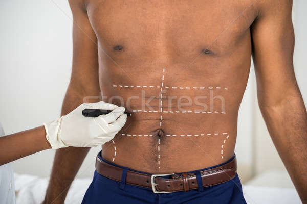 Person's Hand Drawing Correction Lines On Abdomen Of Man Stock photo © AndreyPopov