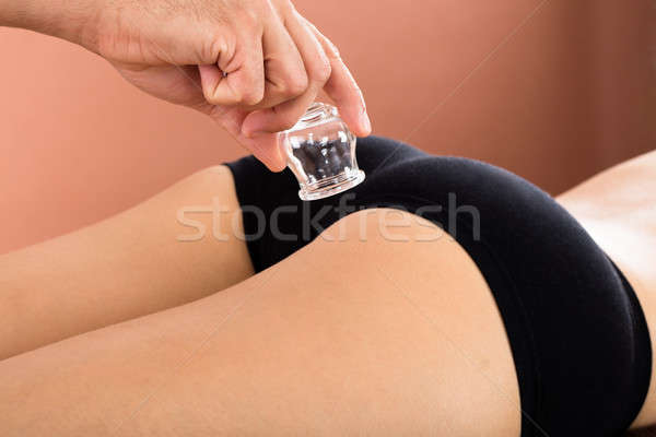 Close-up Of A Therapist Using Cup For Cupping Therapy Stock photo © AndreyPopov