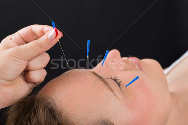 Persoană acupunctura ac faţă femeie Imagine de stoc © AndreyPopov