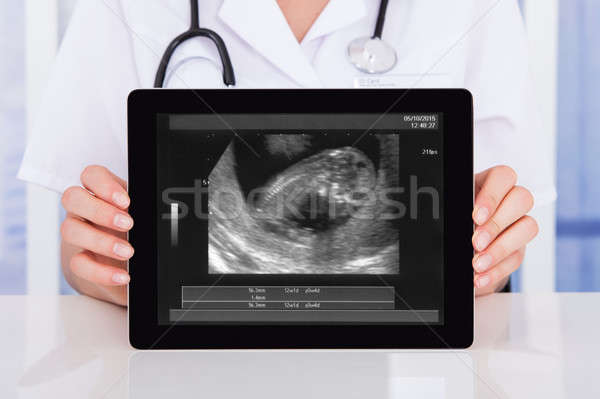 Doctor Holding Digital Tablet Stock photo © AndreyPopov