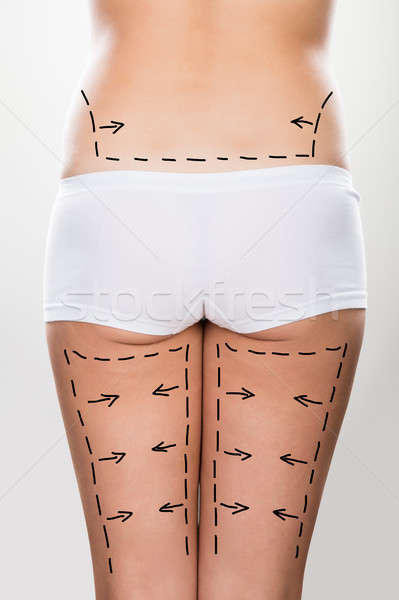 Woman With Correction Lines On Her Thigh Stock photo © AndreyPopov