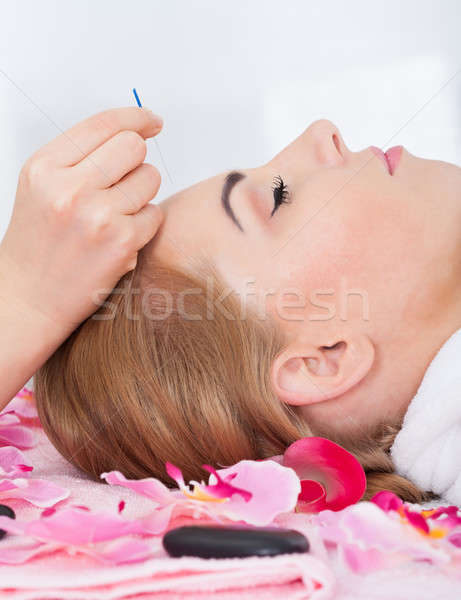 Mujer acupuntura tratamiento primer plano flor Foto stock © AndreyPopov