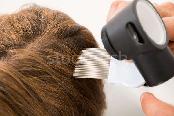 Doctor Hand Doing Treatment Of Patient's Hair Stock photo © AndreyPopov