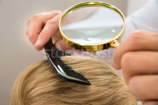 Stock photo: Dermatologist Looking Blonde Hair Through Magnifying Glass