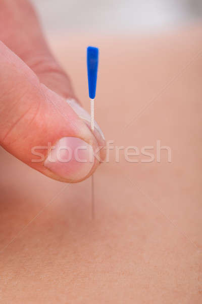 Akupunktur tedavi spa makro detay Stok fotoğraf © AndreyPopov