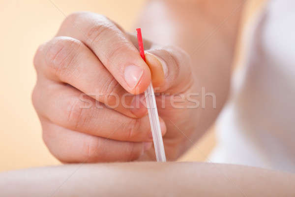 Acupuncturist Placing Needle On Man's Back In Spa Stock photo © AndreyPopov