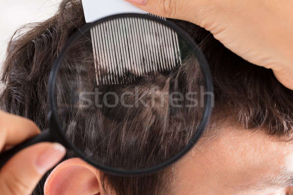 Dermatologue cheveux loupe main médecin Photo stock © AndreyPopov