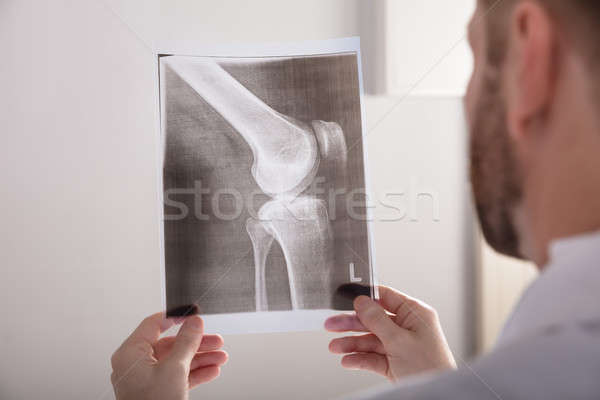 Arzt halten Knie xray männlich Stock foto © AndreyPopov