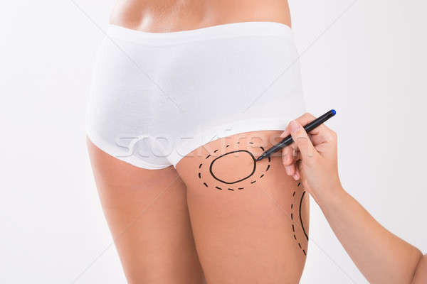 Chirurgien femme liposuccion chirurgie cuisse image Photo stock © AndreyPopov