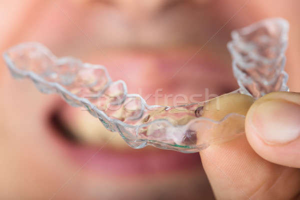 Man Holding Transparent Teeth Aligners Stock photo © AndreyPopov