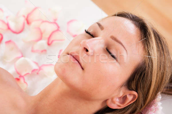 Mujer acupuntura tratamiento línea agujas piel Foto stock © AndreyPopov