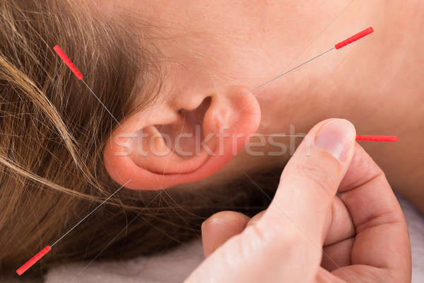 Mano realizar acupuntura terapia primer plano rojo Foto stock © AndreyPopov