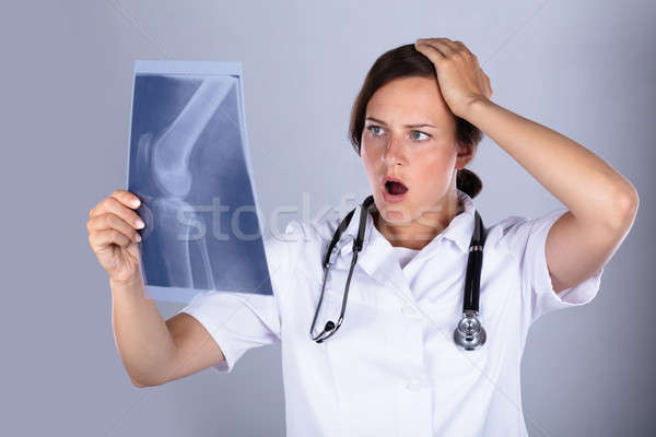 Conmocionado médico examinar rodilla Xray femenino Foto stock © AndreyPopov