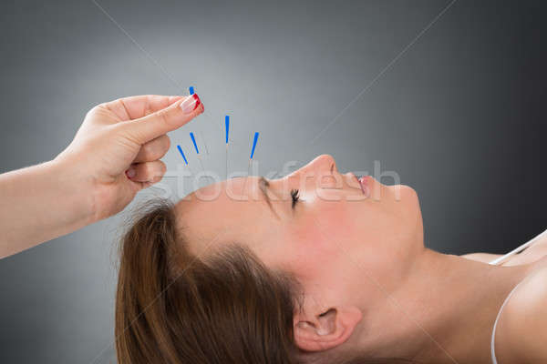 Persona acupuntura aguja cara mujer primer plano Foto stock © AndreyPopov