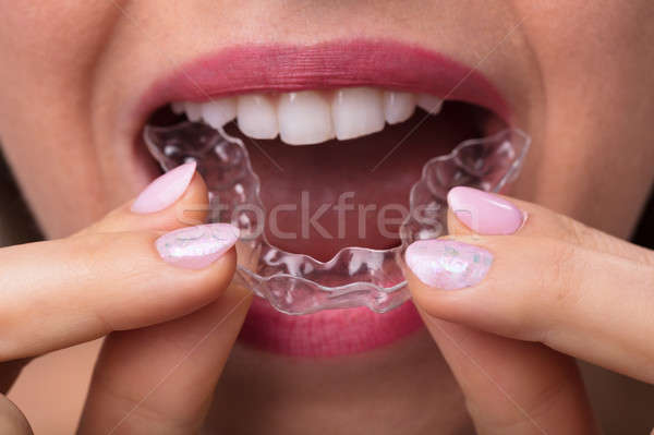 Woman Putting Transparent Aligner In Teeth Stock photo © AndreyPopov