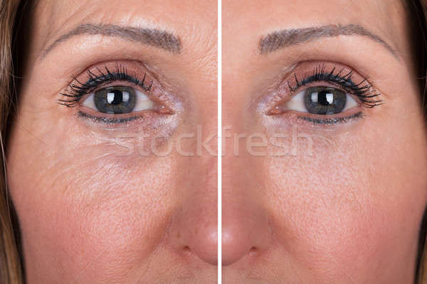 Woman With Before And After Rejuvenation Stock photo © AndreyPopov