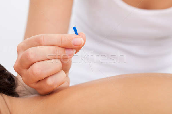 Masszőz tart tű közelkép kéz akupunktúra Stock fotó © AndreyPopov