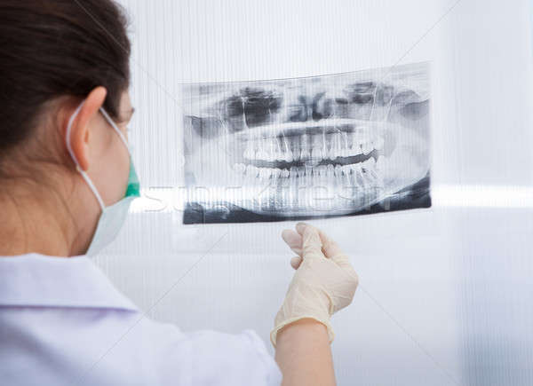 Сток-фото: женщины · стоматолога · глядя · стоматологических · Xray · вид · сзади