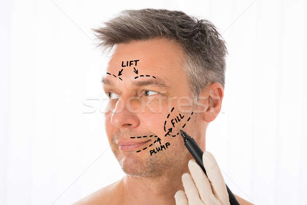 Chirurg tekening correctie lijnen man gezicht Stockfoto © AndreyPopov