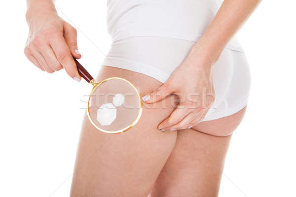 Mujer celulitis lupa primer plano mano salud Foto stock © AndreyPopov