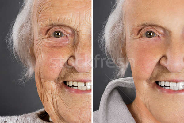 Skin Treatment Before And After Stock photo © AndreyPopov