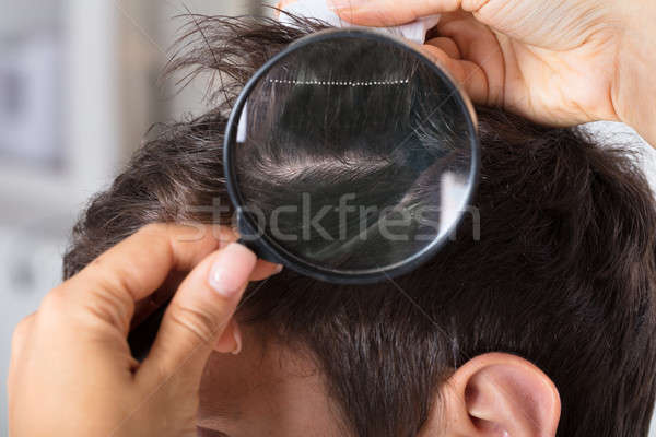 Dermatologist Checking Patient's Hair With Magnifying Glass Stock photo © AndreyPopov
