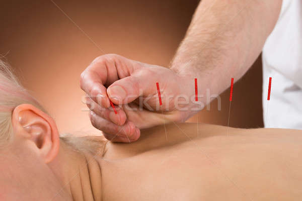 Jeunes personne acupuncture traitement salon de beauté Photo stock © AndreyPopov
