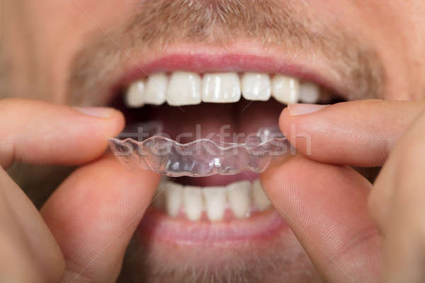 Man Putting Transparent Aligner In Teeth Stock photo © AndreyPopov