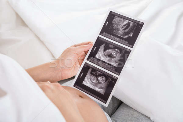 Femme enceinte ultrasons image bébé séance lit [[stock_photo]] © AndreyPopov