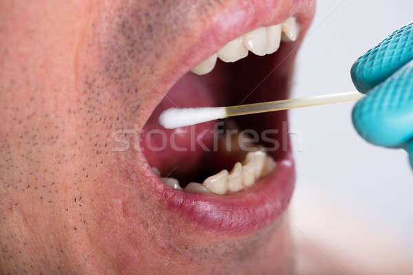 Dentist Making Saliva Test On The Mouth With Cotton Swab Stock photo © AndreyPopov