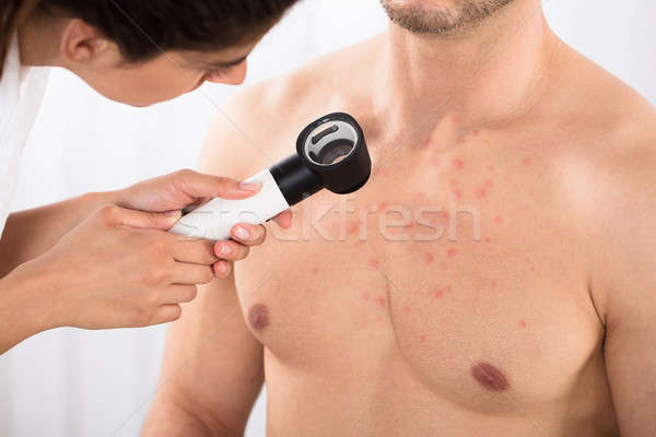 Dermatolog piept medical sănătate pasă Imagine de stoc © AndreyPopov