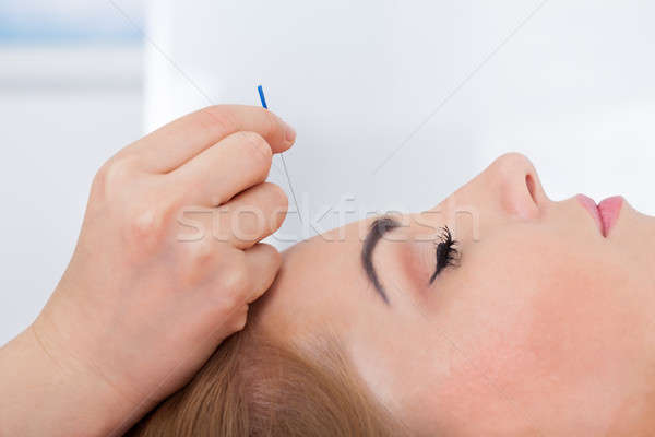 Nő akupunktúra kezelés közelkép fiatal nő kéz Stock fotó © AndreyPopov