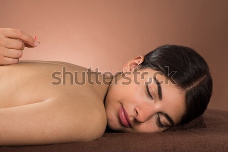 Kadın akupunktur tedavi genç kadın gözleri kapalı Stok fotoğraf © AndreyPopov